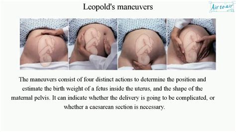 leopold manevrası nedir